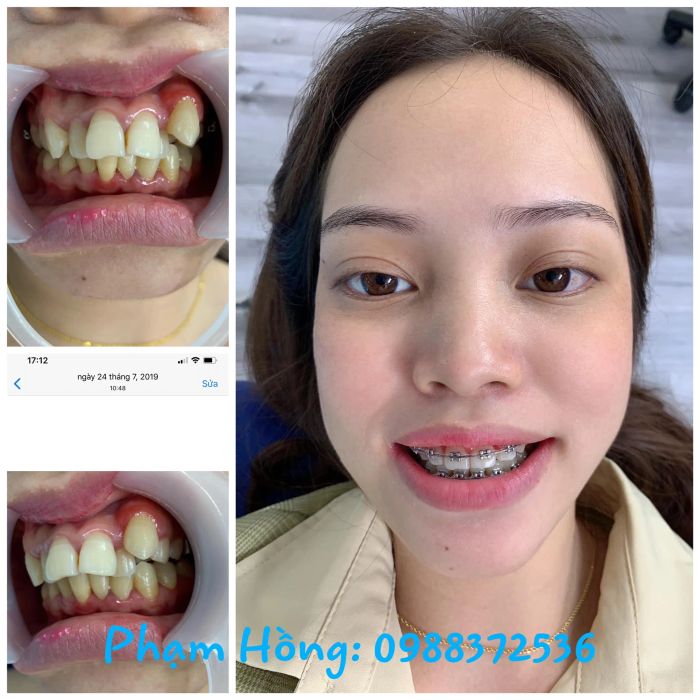 Hình ảnh đội ngũ bác sĩ chuyên môn cao tại Shine Smile