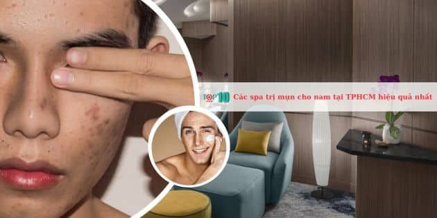 Danh sách các spa trị mụn hiệu quả dành cho nam tại TPHCM
