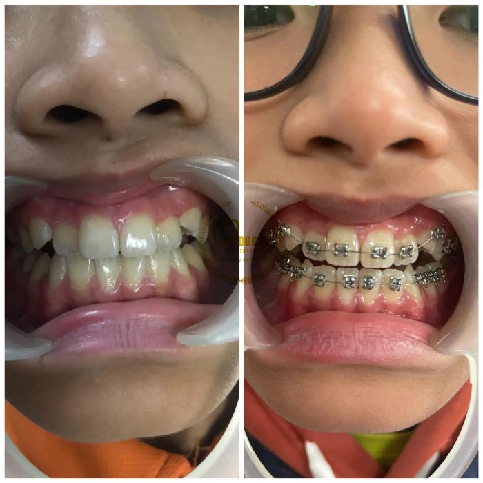 Hình ảnh thực tế Nha Khoa Hà Đương