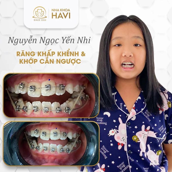 Hình ảnh trực quan về Nha khoa Havi - không gian hiện đại đạt chuẩn y khoa