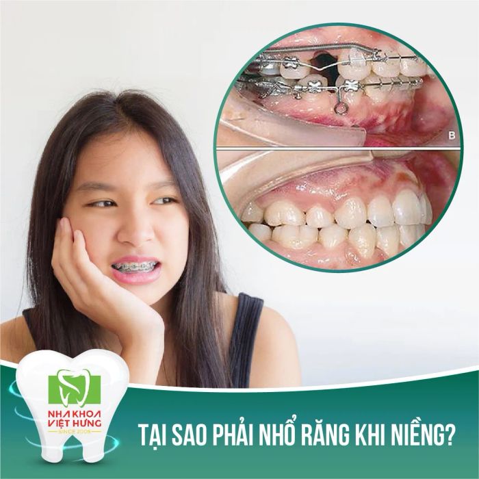 Hình ảnh thực tế Nha Khoa Thẩm Mỹ Việt Hưng