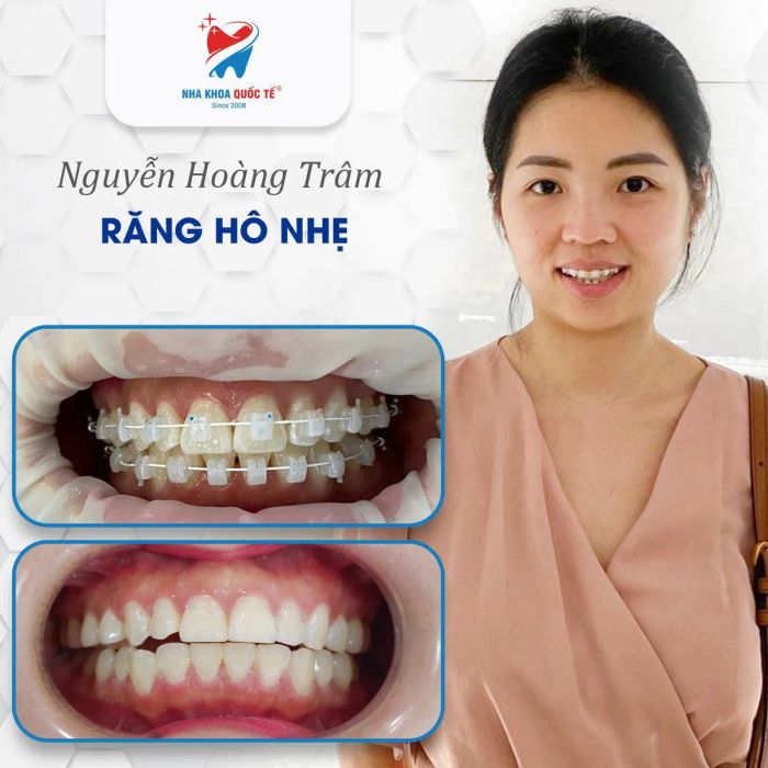 Hình ảnh cơ sở vật chất hiện đại tại Trung Tâm Nha Khoa Quốc Tế