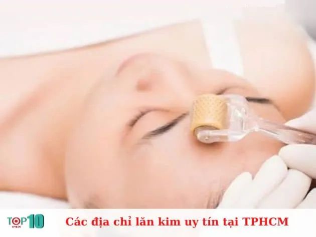 Địa chỉ lăn kim uy tín - hiệu quả tại TP.HCM