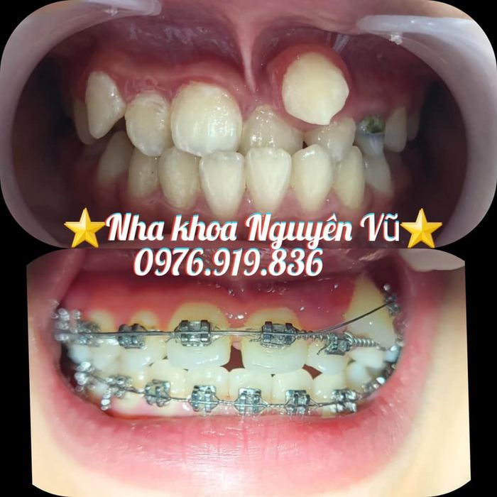 Hình ảnh chân thực tại Nha Khoa Nguyên Vũ – Ảnh 1