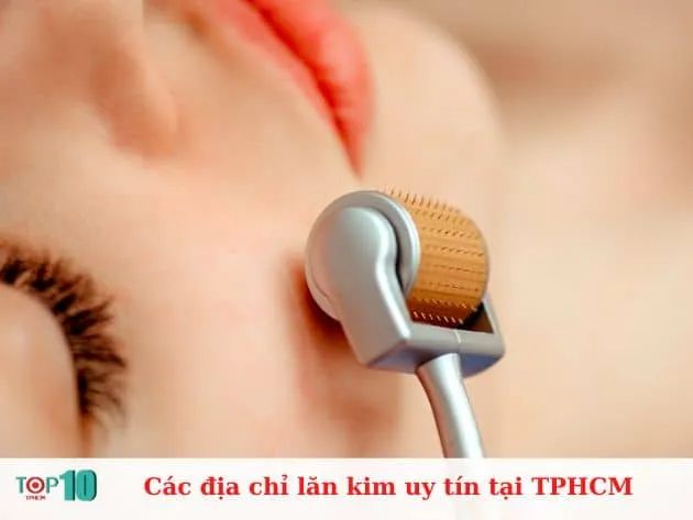 Hành trình khám phá những địa chỉ lăn kim chuẩn y khoa tại TP.HCM