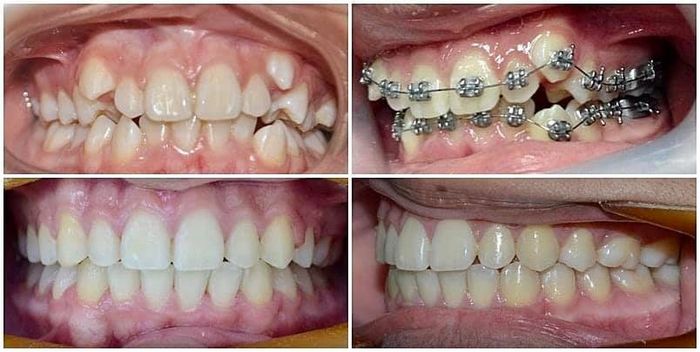 Khoảnh khắc chân thực tại Nha Khoa Minh Phúc – Ảnh số 3