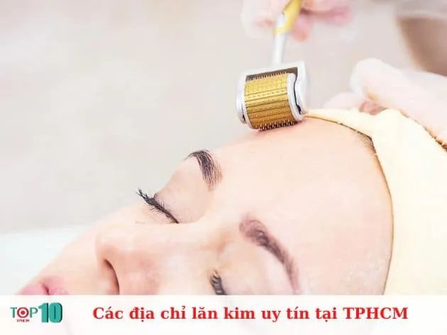 Danh sách địa chỉ lăn kim đạt chuẩn y khoa tại TP.HCM
