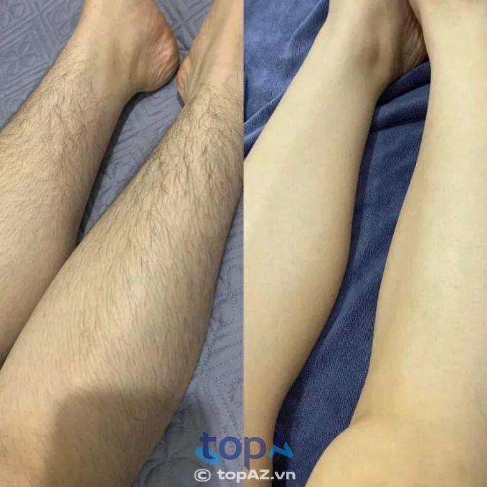 Mint Spa Quận 6 - Địa chỉ vàng cho làn da không tì vết