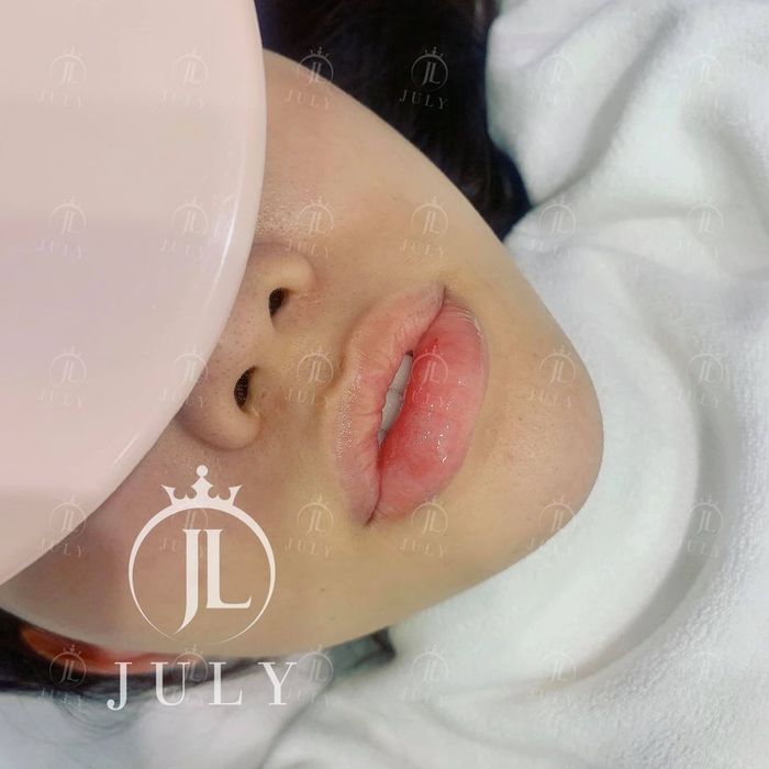 Không gian sang trọng và chuyên nghiệp tại July Beauty Clinic