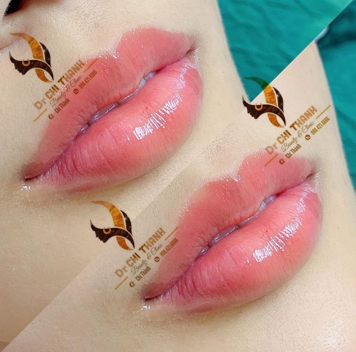 Không gian sang trọng và hiện đại tại Dr Chi Thanh Beauty & Clinic