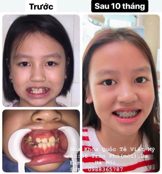 Nha Khoa Quốc Tế Việt Mỹ ảnh 2