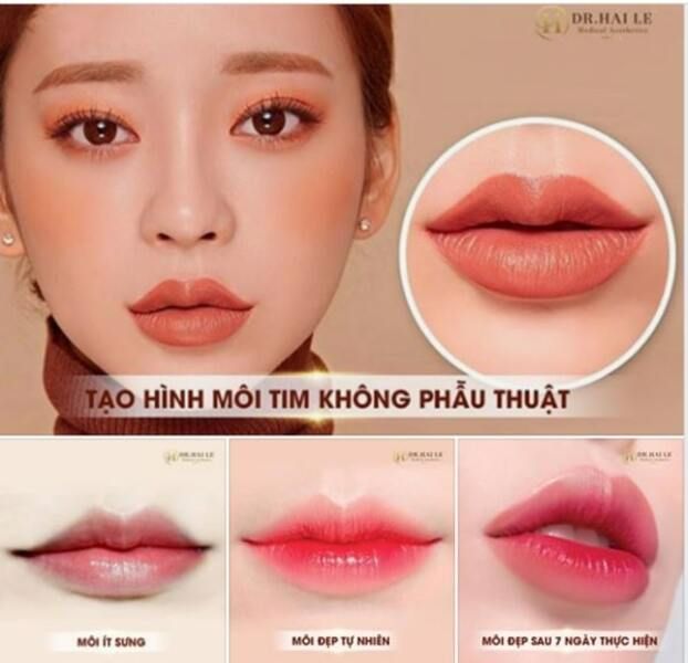 Không gian sang trọng và hiện đại tại Viện Thẩm Mỹ Dr.Hải Lê
