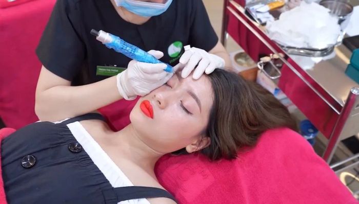 Hình ảnh quy trình xóa xăm chuyên nghiệp tại Thu Cúc Clinics
