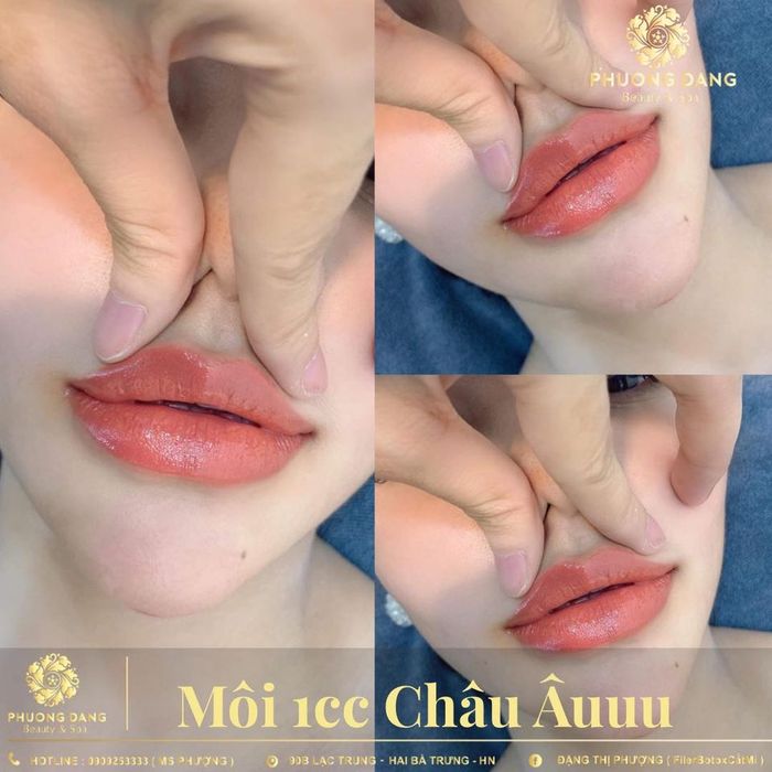 Hình ảnh Phuong Dang Beauty