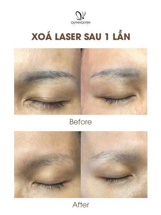 Hình ảnh thực tế về không gian sang trọng tại QuynhQuyen Beauty Center