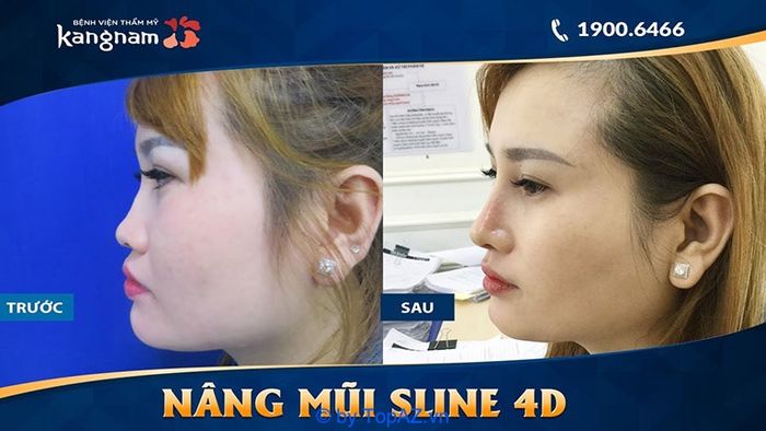 Bệnh viện thẩm mỹ Kangnam có tốt không? Liệu có phải là cơ sở lừa đảo không?