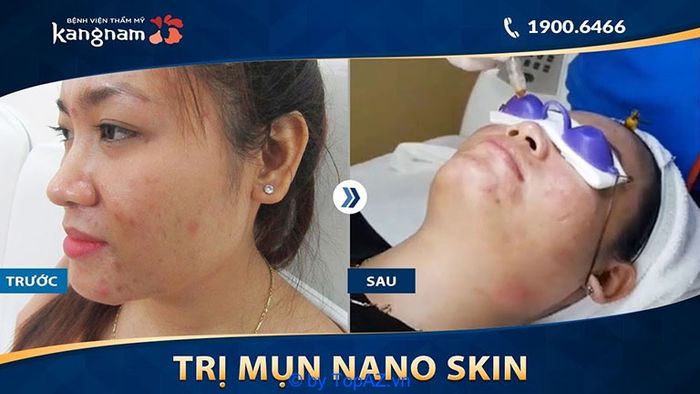 Bệnh viện thẩm mỹ Kangnam là một địa chỉ đáng tin cậy, luôn đáp ứng những yêu cầu khắt khe về chất lượng và dịch vụ.