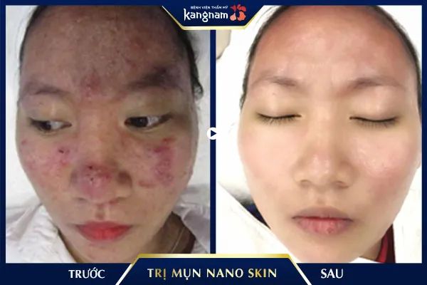 Hình ảnh Bệnh viện Thẩm mỹ Kangnam