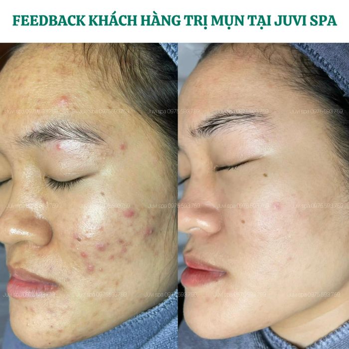 JUVI SPA - Không gian sang trọng với công nghệ hiện đại