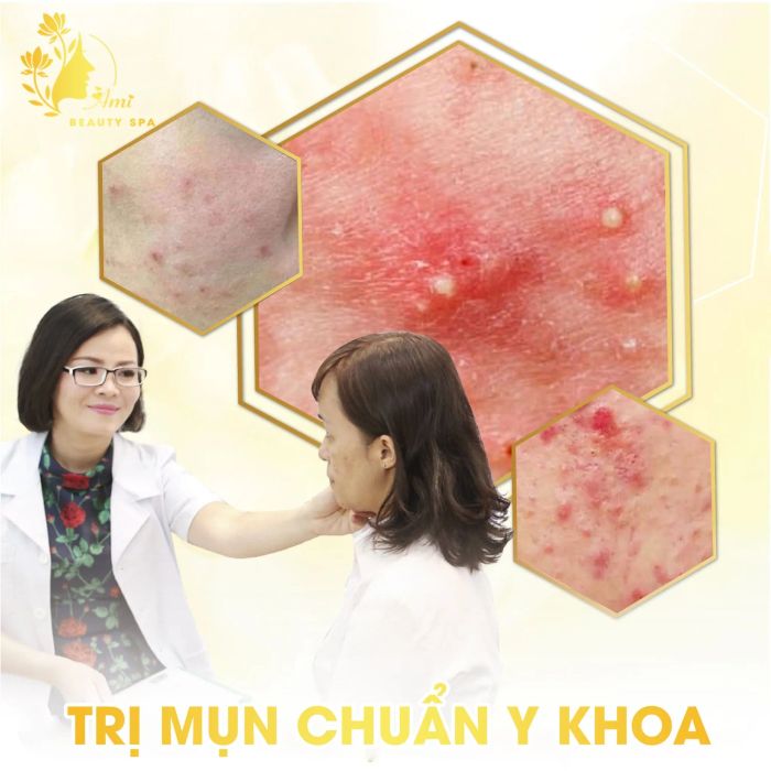 Thảo Ami Spa Hà Nội - Hình ảnh thực tế liệu trình chăm sóc da đẳng cấp