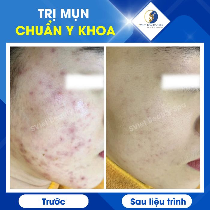 Không gian trị liệu sang trọng tại Sviet Beauty Spa