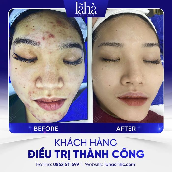 Lã Hà Clinic - Không gian điều trị hiện đại, sang trọng