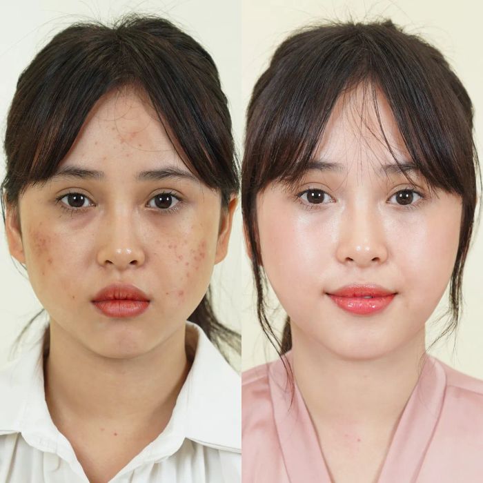 Không gian sang trọng tại Thẩm mỹ quốc tế Bally