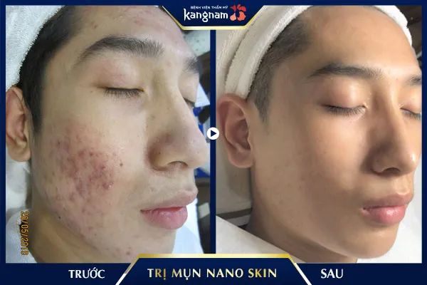Không gian sang trọng tại Bệnh viện Thẩm mỹ Kangnam