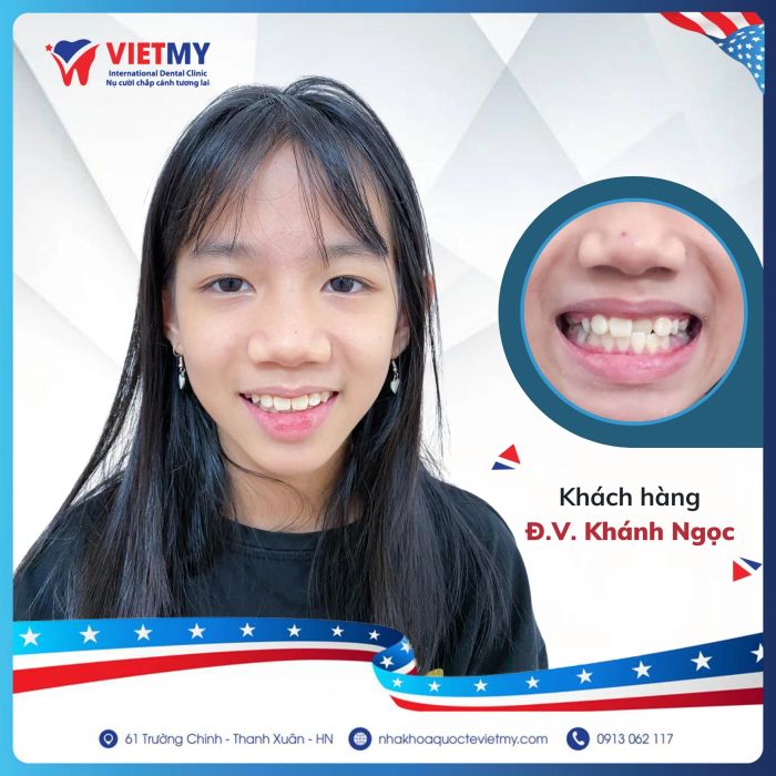Hình ảnh thực tế tại Nha Khoa Quốc Tế Việt Mỹ