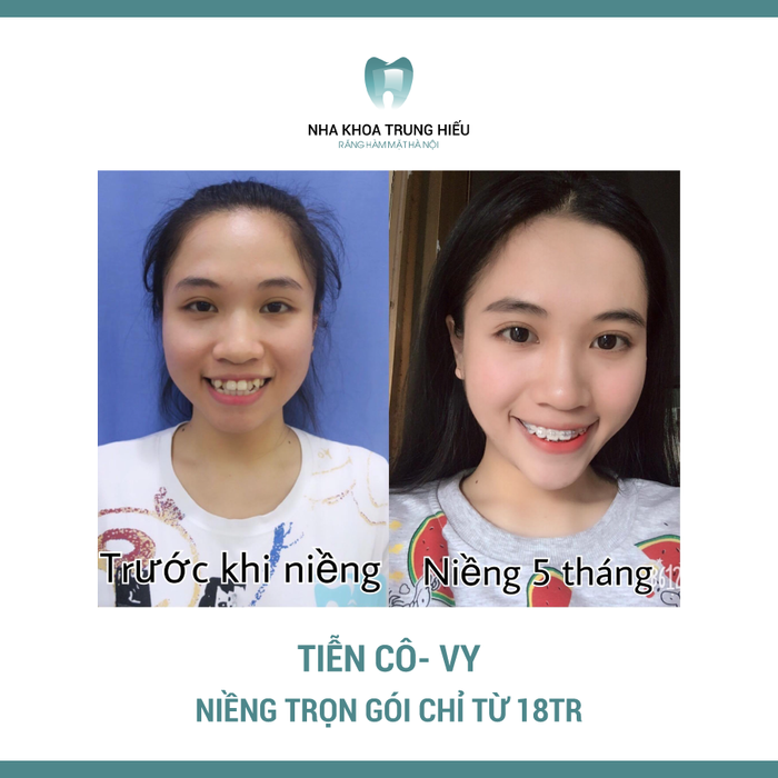 Hình ảnh cơ sở vật chất hiện đại tại Nha Khoa Trung Hiếu