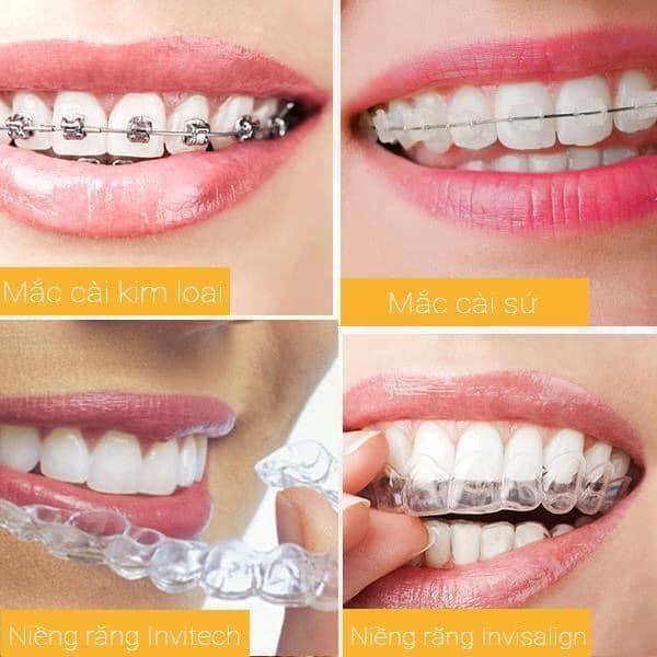 Không gian hiện đại và tiện nghi tại Nha Khoa Á Châu Asian Smile