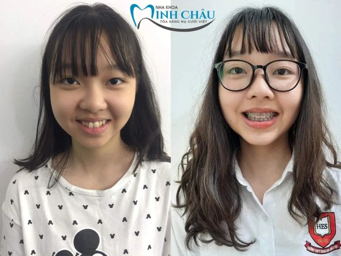 Không gian hiện đại và vô trùng tại Nha Khoa Minh Châu