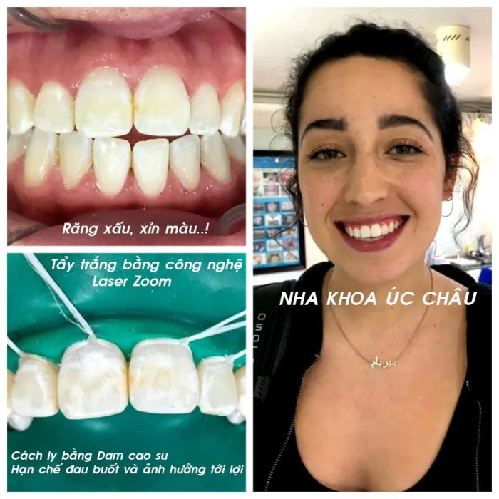 Nha Khoa Úc Châu - Hình ảnh 2