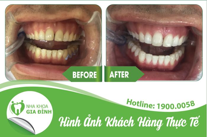 Nha Khoa Gia Đình - Hình ảnh 1