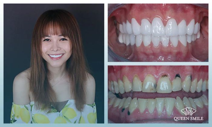 Nha khoa thẩm mỹ Queen Smile ảnh 1