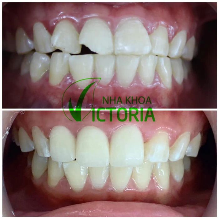Nha Khoa Victoria Gia Lâm ảnh 2