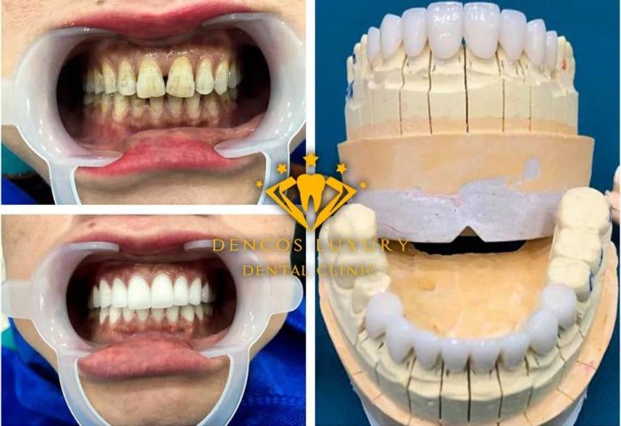 Nha Khoa Quốc Tế Dencos Luxury - Hình ảnh 1