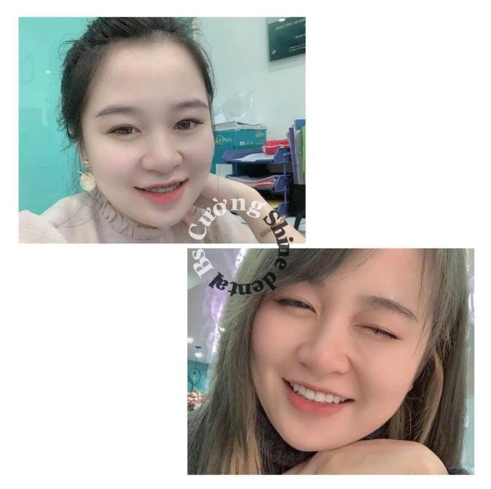 Không gian sang trọng và hệ thống máy móc hiện đại tại Nha Khoa Shine