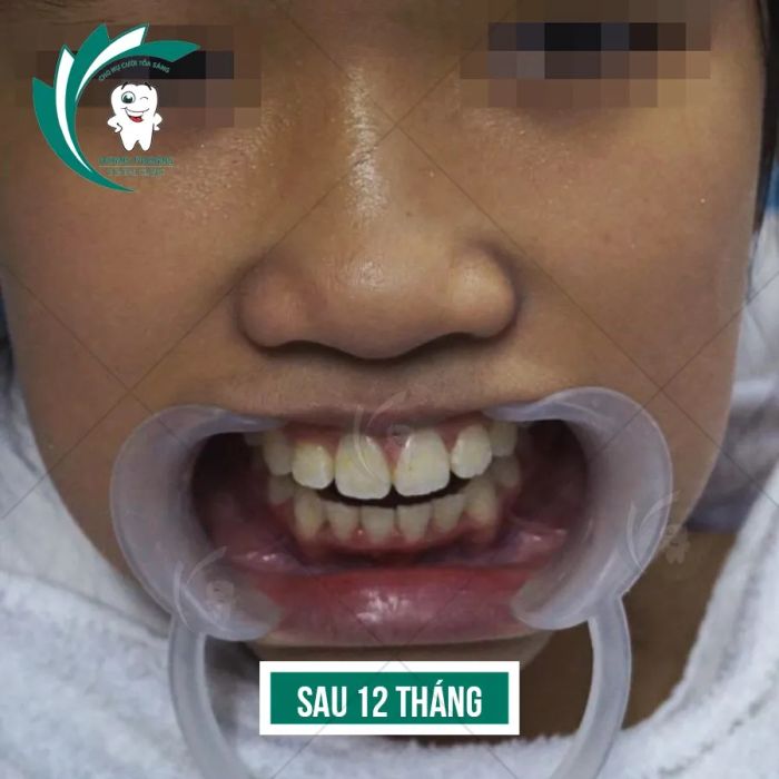 Không gian hiện đại và tiện nghi tại Nha Khoa Hồng Phong