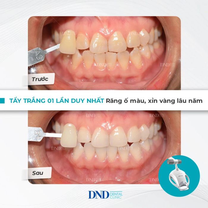 Nha Khoa Quốc Tế DND - Hình ảnh 2