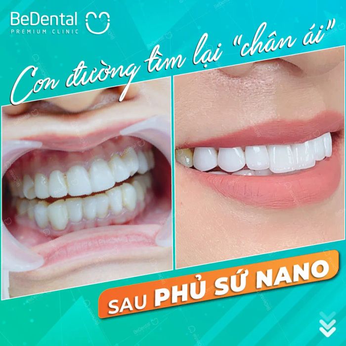 Nha Khoa Thẩm Mỹ BeDental ảnh 2