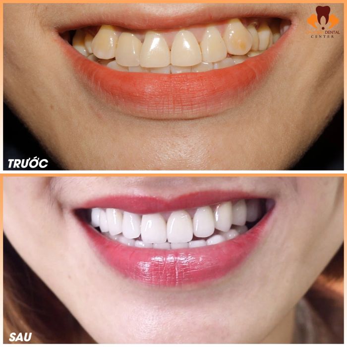 Nha Khoa Trâu Quỳ - Dr Hưng Dental Center ảnh 1