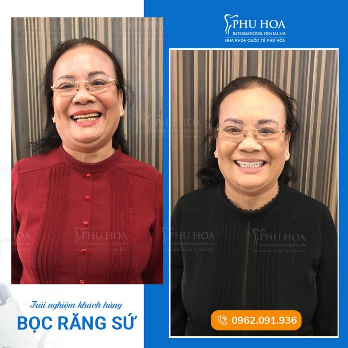 Nha khoa Quốc tế Phú Hoà ảnh 1