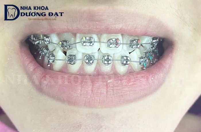 Hình ảnh cơ sở vật chất hiện đại tại Nha khoa Dương Đạt