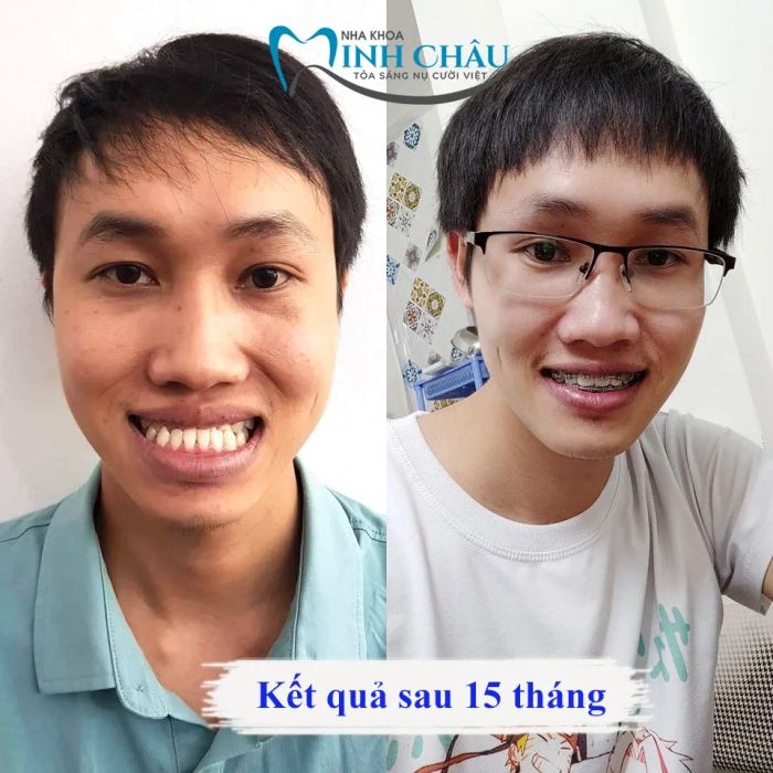 Đội ngũ bác sĩ chuyên môn cao và tận tâm tại Nha Khoa Minh Châu