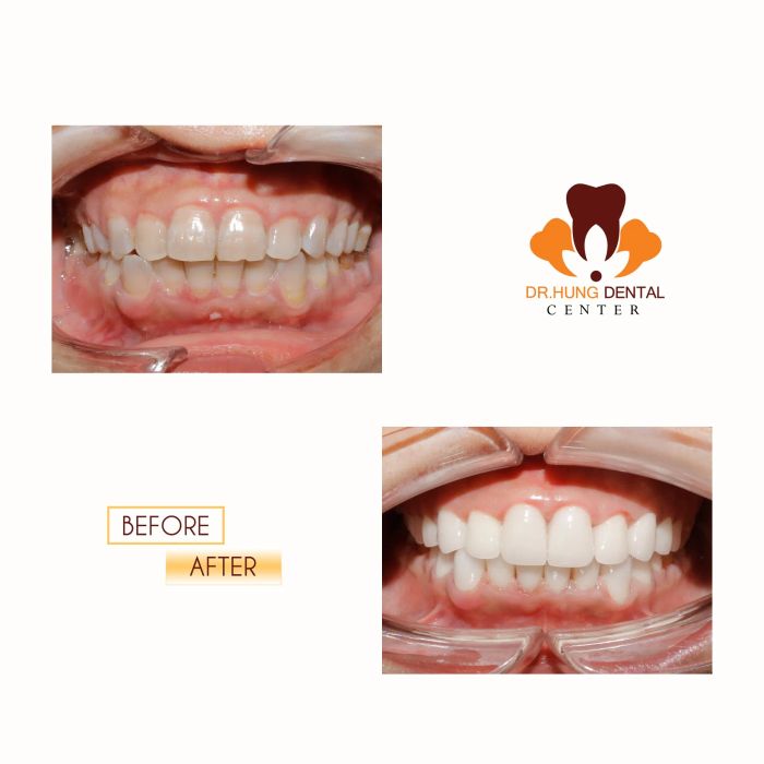 Nha Khoa Trâu Quỳ - Dr Hưng Dental Center ảnh 2