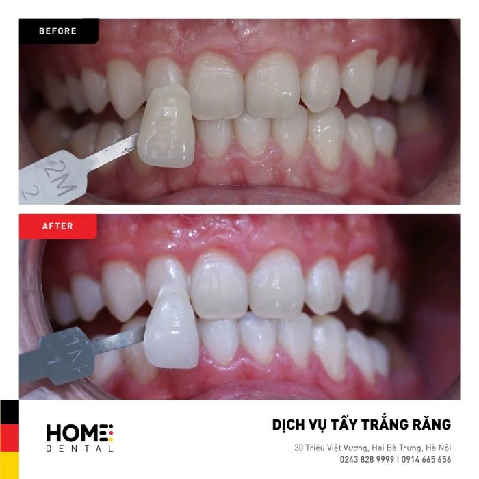 Home Dental - Hình ảnh 1