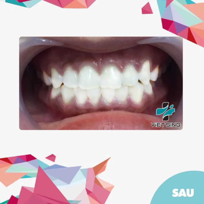 Nha Khoa Quốc Tế Việt - Sing - Hình ảnh 1