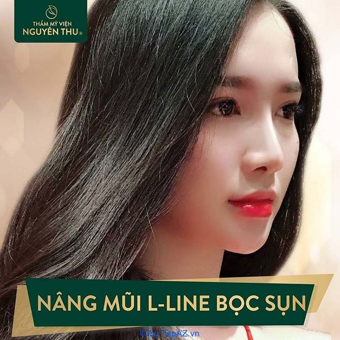 Địa chỉ nâng mũi chất lượng hàng đầu tại Đà Nẵng