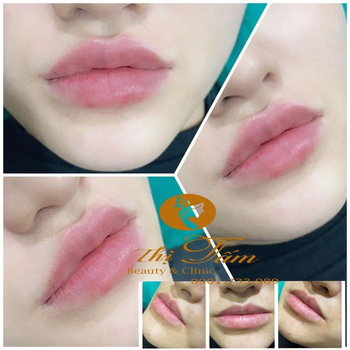 Thị Tấm Beauty & Clinic hình ảnh 2